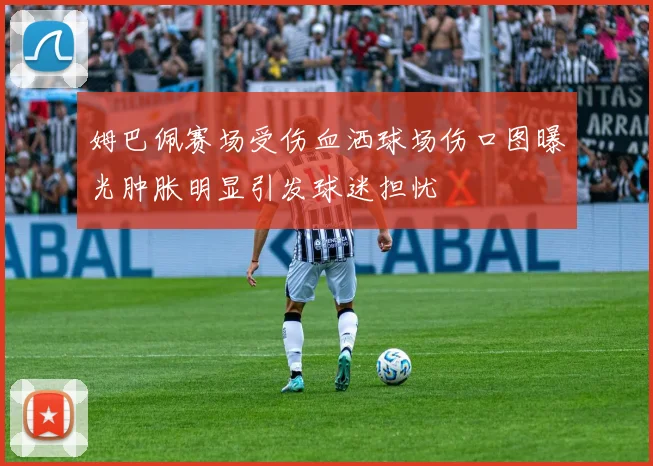 姆巴佩赛场受伤血洒球场伤口图曝光肿胀明显引发球迷担忧